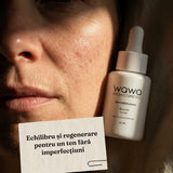 DermaSolutions Booster Acné 100% cuidado molecular de la piel