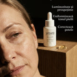 DermaSolutions Booster Pecas/Manchas/Melasma 100% cuidado de la piel molecular
